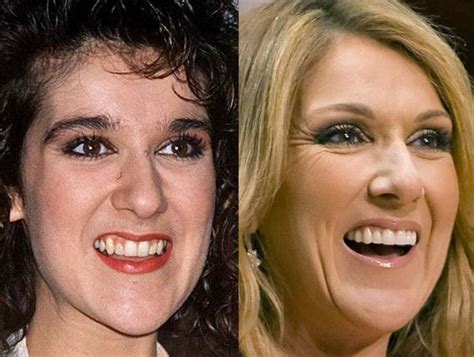 celine dion fake teeth|celine dion before plastic surgery.